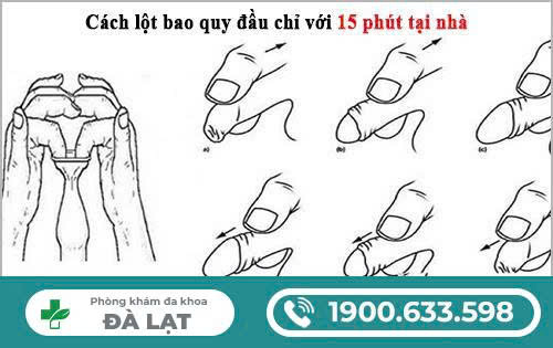 Hình ảnh minh họa